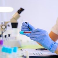 Identifican más de un centenar de genes implicados en la metástasis de múltiples cánceres