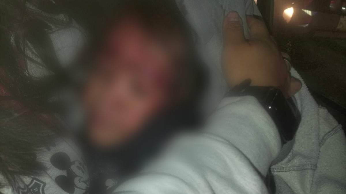 Policía hiere con arma de fuego a una niña de cuatro años durante un operativo
