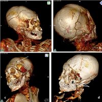 Las nuevas tecnologías lograron reconstruir la muerte violenta de dos momias de hace más de mil años
