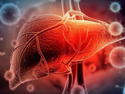 Menos de una tercera parte de enfermos con hepatitis C recibe cura en EU