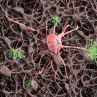 Alzheimer afecta de esta manera a personas con síndrome de Down