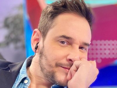 “Me operé todo”: Rodrigo Lussich sacó a la luz la costosa inversión que hizo para cambiar su aspecto