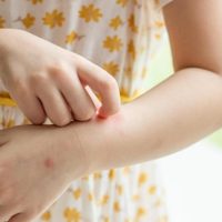 La controversial, pero efectiva técnica que alejaría a los mosquitos de forma definitiva