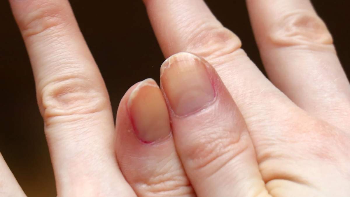 Uñas. Fuente: (X)