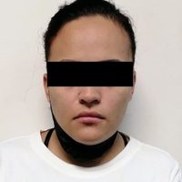 Falsa doctora es detenida en NL, realizaba aqualipo sin ser cirujana; está acusada de feminicidio