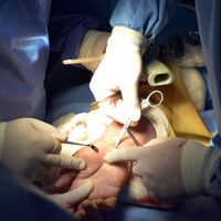 Hospital de Traumatología de Lomas Verdes realiza 850 cirugías de mano al año