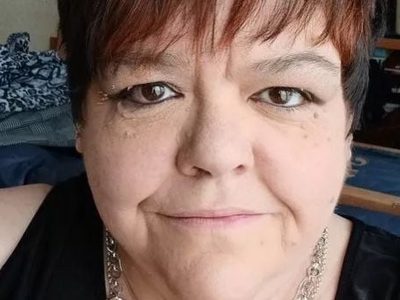 Mujer irlandesa desarrolló bacteria carnívora; quedó en coma por usar su brasier