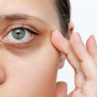 Con solo 5 ingredientes, la mezcla natural para reducir ojeras y devolverle vitalidad a la piel de tu rostro