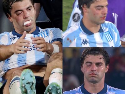 Marcos Rojo fracturó a Santi Sosa y así quedó el futbolista de Racing