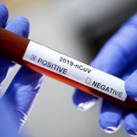 El coronavirus no se detiene en Zapala: confirman 29 nuevos casos positivos