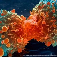 El cáncer cervicouterino es la segunda causa de muerte femenina en México, alerta un especialista