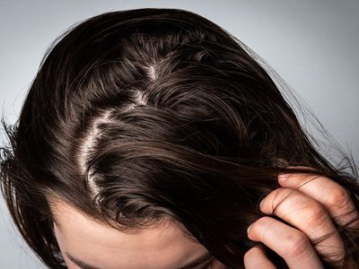 Si tenés el cabello muy graso, prepará esta mascarilla "mágica" para dejarlo totalmente hermoso