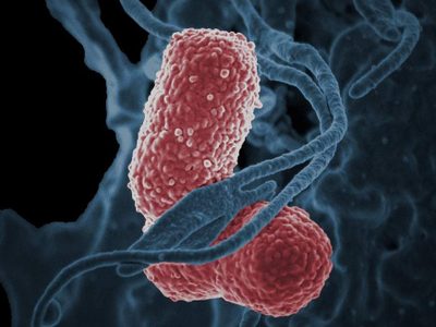 Trece niños mueren por brote de la bacteria Klebsiella oxytoca en Edomex