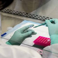 ¡Urgente! Pronostican cuándo podría estar una vacuna contra el coronavirus