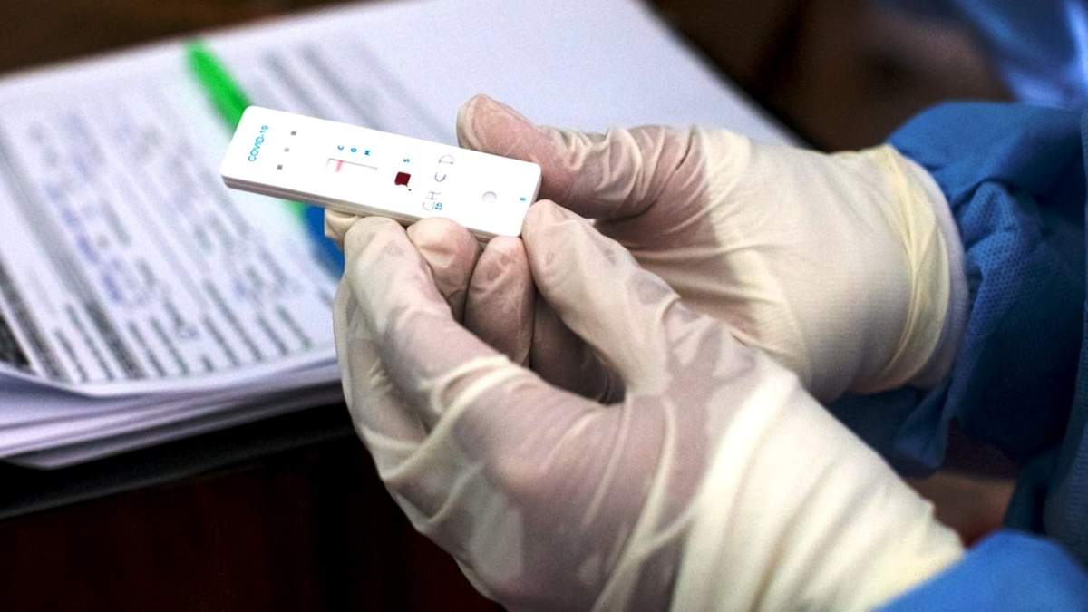 Prueba de coronavirus. Fuente: (Twitter)