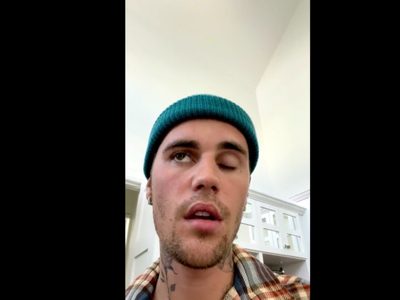 Así es el síndrome de Ramsay Hunt por el cual Justin Bieber no da conciertos