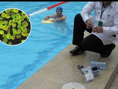 Bacteria “come cerebros” mata a otra persona en Texas, EU