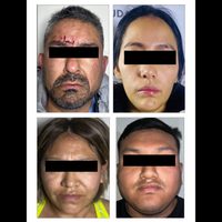 Caen cuatro presuntos miembros del Cártel de Sinaloa en Xochimilco e Iztacalco