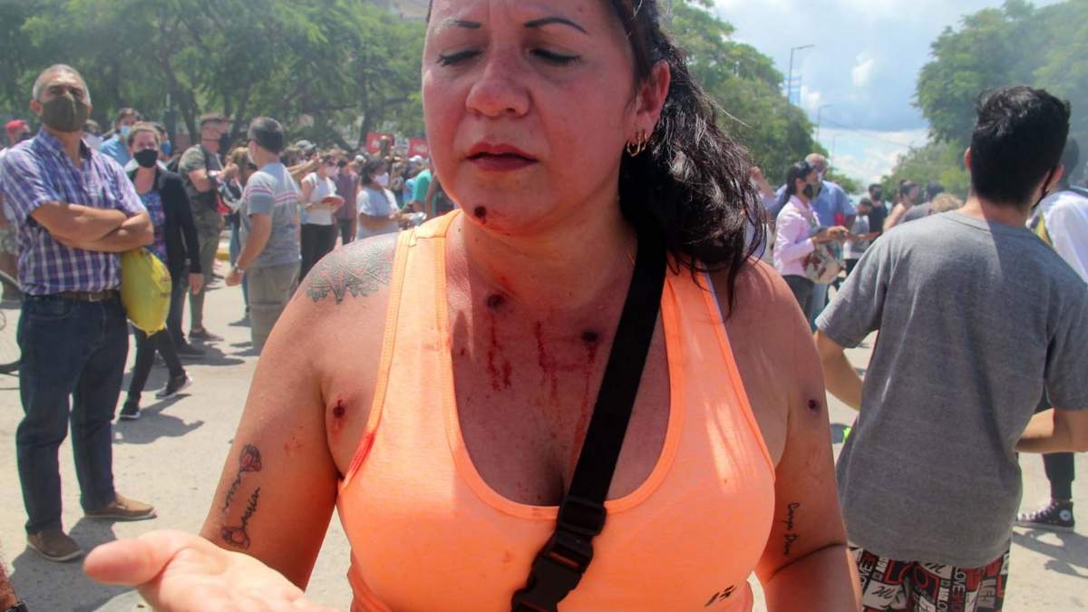 Una mujer herida con balas de goma en Formosa. Fuente: (Twitter)
