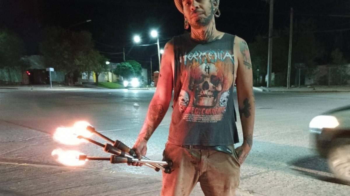 El malabarista de Rincón se recupera de sus quemaduras. Fuente: (Facebook)