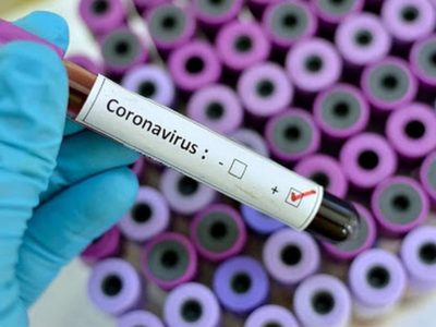 Diputado de Neuquén dio positivo de coronavirus
