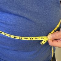 Nuevo plan de diagnóstico cambiaría los parámetros para definir la obesidad
