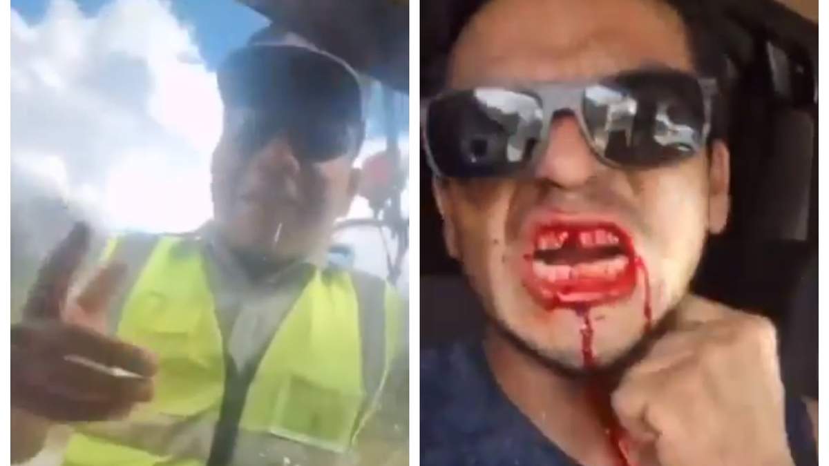 El elemento de la Guardia Nacional y el chofer herido