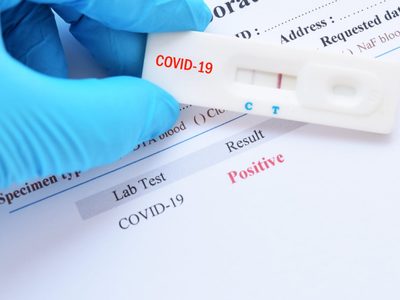 Neuquén empezó a cobrar los tests de coronavirus