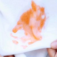 Sin usar agua oxigenada: eliminá las manchas de sangre de las telas con este sencillo y efectivo truco
