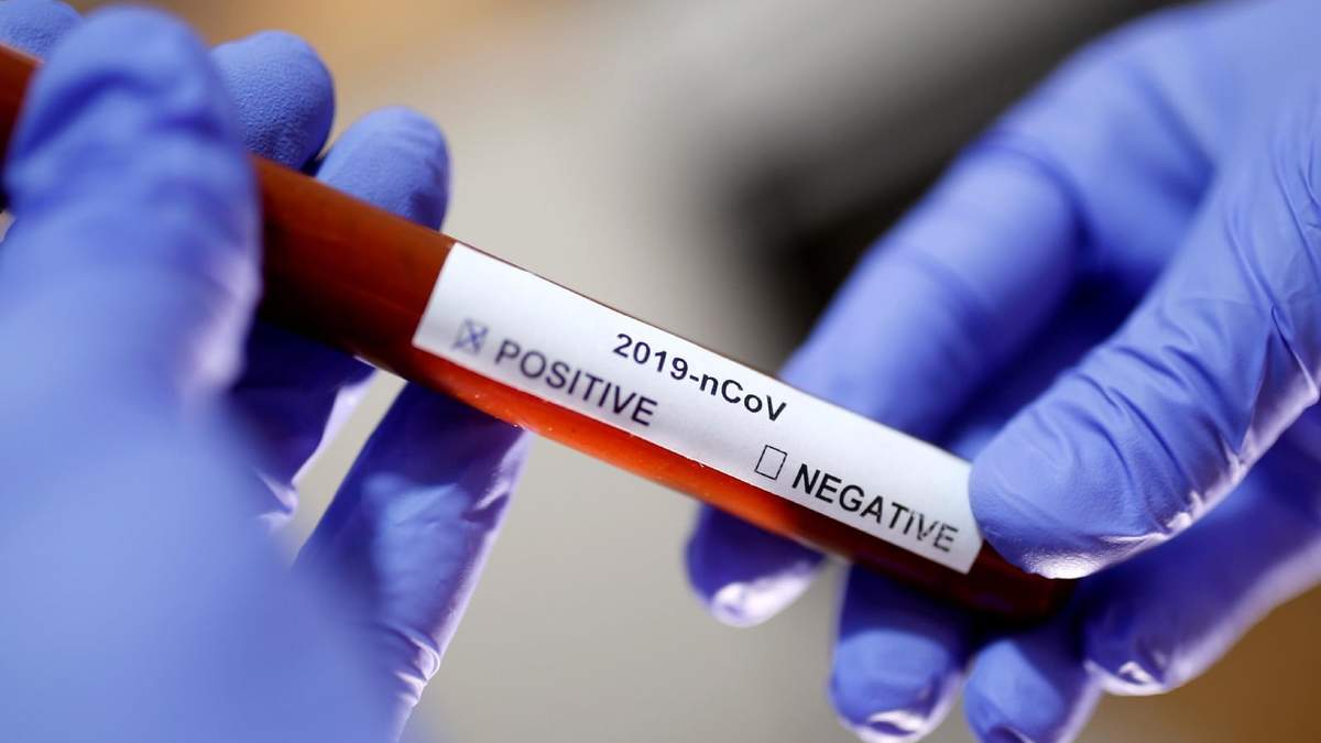 Muestra para el diagnóstico clínico de coronavirus. Fuente: (Twitter)