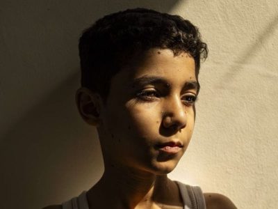 Retrato de un niño palestino que perdió ambos brazos es la Foto del Año de World Press Photo