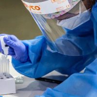 Proyecto Mosaico busca vacuna contra el VIH/SIDA