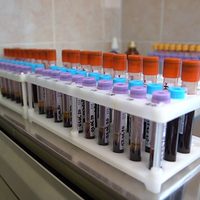 Ensayos de vacuna rusa contra el covid-19 muestran que es segura y tolerable