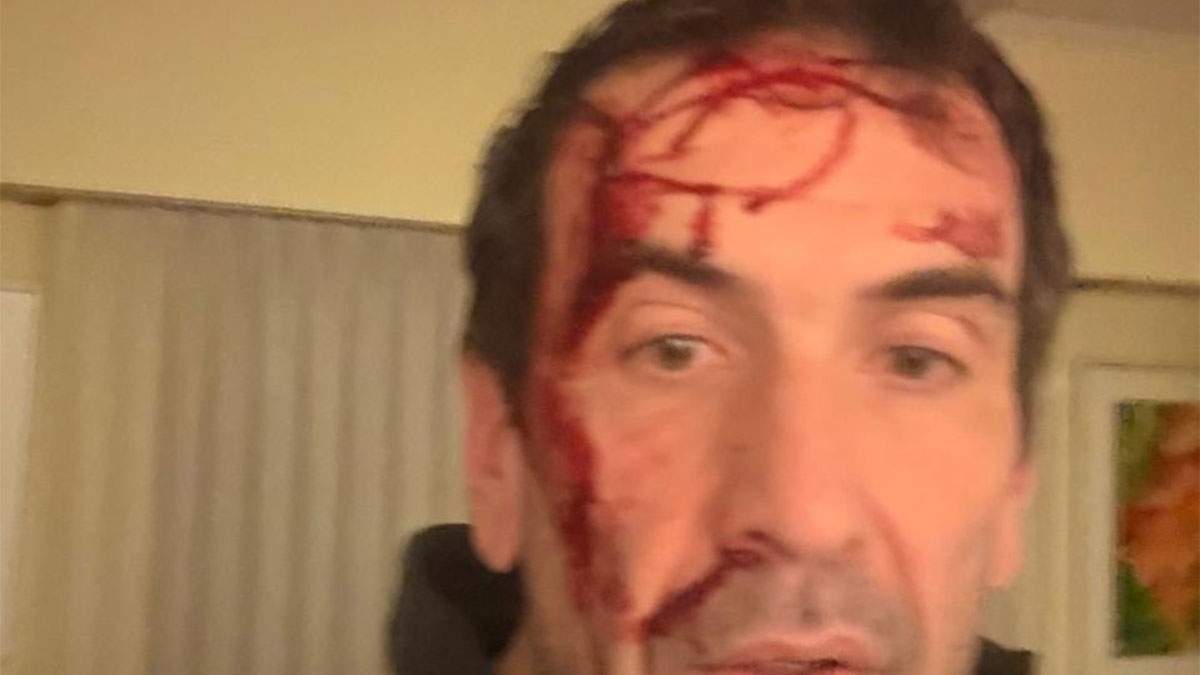 Pablo Cervi fue salvajemente agredido.