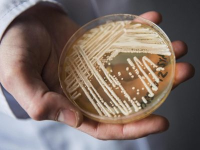 Brasil habría detectado su primera infección por un hongo “superresistente" y potencialmente letal