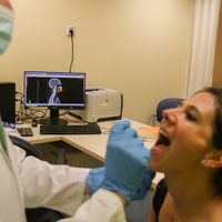 Expertos advierten que los casos de tumores de cabeza y cuello pueden aumentar un 13% por el VPH