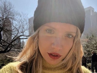 ¡Qué dolor! Laurita Fernández sufrió un accidente en plena cuarentena y subió foto