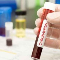"Coronavirus en Neuquén": 31 casos sospechosos y se aguardan más resultados