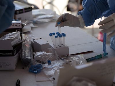 Vitamina D reduce el riesgo de muerte o enfermedad grave por covid-19, concluye estudio