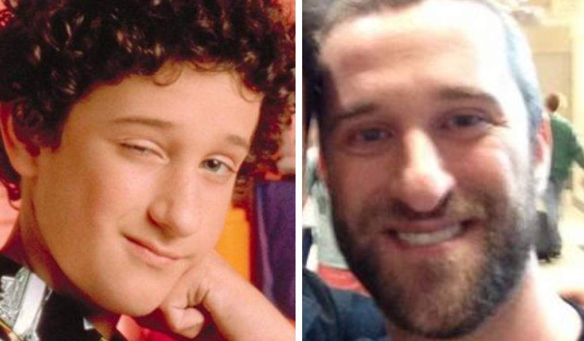 El actor estadounidense Dustin Diamond