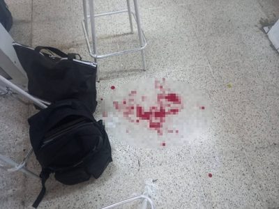 Alumno apuñala a maestro en secundaria de Huimanguillo, Tabasco; lo reportan grave