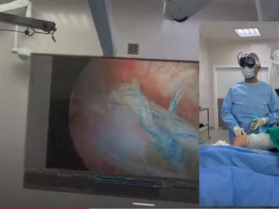 Cirujano realiza una operación usando el Apple Vision Pro y comparte el video