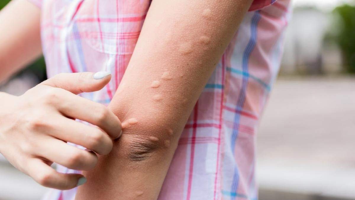 Mosquitos. Fuente: (Instagram)
