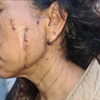 Sujeto casi mata a madre e hija, y para la fiscalía de Puebla solo se trató de un robo