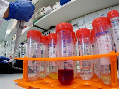 Situación preocupante en La Patagonia: ¡24 casos de coronavirus en un día!
