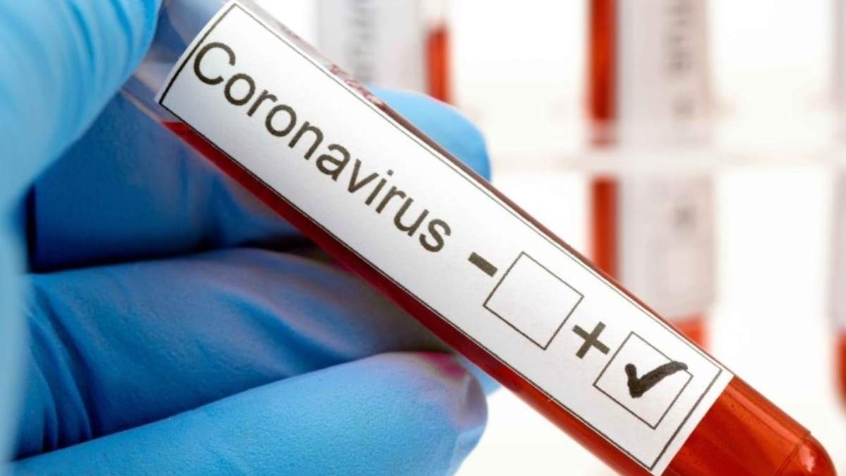 Coronavirus. Fuente: (Twitter)