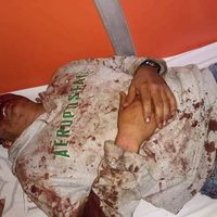 CNTE denuncia agresión de policías federales a un maestro en Michoacán
