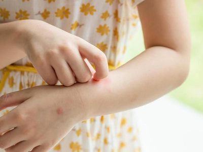 La controversial, pero efectiva técnica que alejaría a los mosquitos de forma definitiva