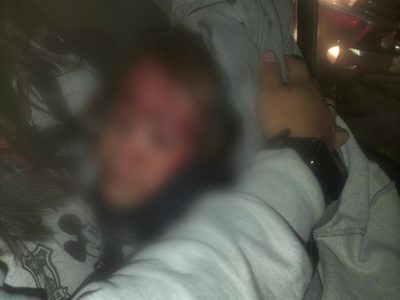 Policía hiere con arma de fuego a una niña de cuatro años durante un operativo en Puebla