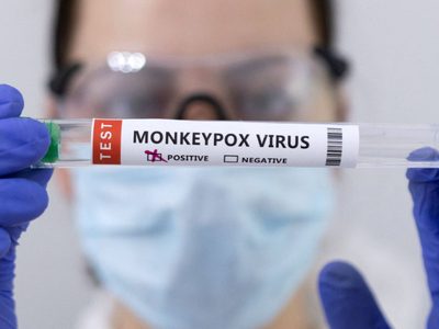 España logró obtener la secuencia completa del virus de la viruela del mono